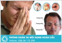 Viêm xoang là gì - cách chữa trị viêm xoang hiệu quả