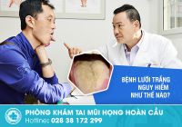 Bệnh lưỡi trắng là gì? và có nguy hiểm không?