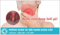 Thế nào là bệnh viêm họng lưỡi gà dài và dấu hiệu nhận biết?