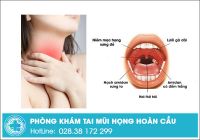 Bị đau họng là dấu hiệu của bệnh gì và cần điều trị ra sao?