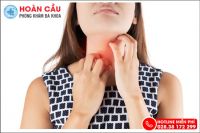 Bị Khô Họng Dấu Hiệu Báo Trước Nhiều Bệnh Lý Nguy Hiểm