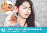 Bị ù tai thường xuyên là bị bệnh gì? Cách khắc phục hiệu quả