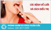 Các bệnh về lưỡi thường gặp nhưng không phải ai cũng biết