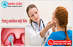 Cảnh giác với triệu chứng sưng amidan một bên