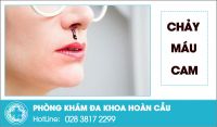 Chảy máu cam: hiện tượng bệnh lý không nên xem thường