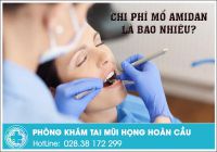 Mổ amidan bao nhiều tiền? và mổ ở đâu đáng tin cậy?