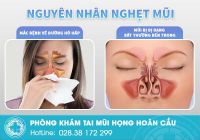 Cách chữa nghẹt mũi cực kỳ hiệu quả không tái phát