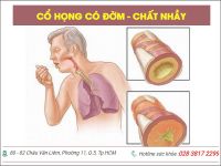 Cổ họng có đờm, dịch nhầy - cảnh báo nhiều bệnh lý nguy hiểm