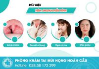 Dấu hiệu bị amidan 90% bệnh nhân mắc phải đều có