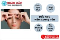 Dấu hiệu nhận biết viêm xoang trán dễ phát hiện tại nhà