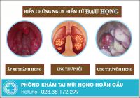 Đau họng là biểu hiện của bệnh gì, nguy hiểm không?