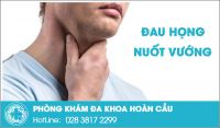 Đau họng nuốt vướng không hề đơn giản