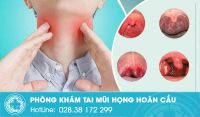 Rát cổ họng làm sao để khỏi?