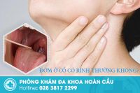 Hiện tượng đờm ở cổ có bình thường không?