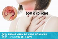 Đờm ở cổ họng lâu ngày là bị gì?