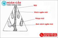 Gai vách ngăn mũi có nguy hiểm không và khi nào nên mổ?