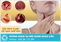 Nổi hạch dưới hàm cảnh báo bệnh lý gì?