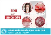 Ho có đờm là bệnh gì và cần chữa trị như thế nào mau khỏi?