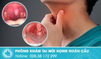 Họng nổi mụn: dấu hiệu cảnh báo bệnh lý vòm họng nguy hiểm