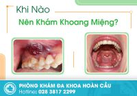 Khám khoang miệng giúp phát hiện bất thường ở vòm họng