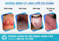 Cẩn thận với dấu hiệu lưỡi có chấm đỏ