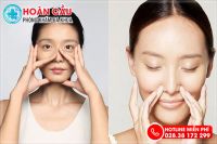 Nắn vách ngăn mũi – cách điều trị lệch vách ngăn không cần mổ