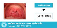 Ngứa họng kéo dài: Nguy cơ mắc phải những căn bệnh nguy hiểm