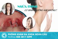 Ngứa họng là bình thường hay bất thường?