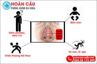Nguyên nhân lệch vách ngăn mũi điển hình và cách chữa trị đáng tin cậy