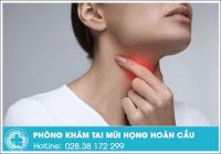 Viêm họng và những điều cần nên biết