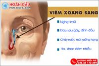 Những triệu chứng và biến chứng tồi tệ khi bị viêm xoang sàng