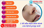 Những vấn đề xoay quanh bệnh lý polyp mũi mà có thể bạn chưa biết