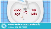 Địa chỉ chữa chứng nước bọt có máu hiệu quả tại TPHCM