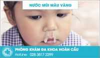 Nước mũi màu vàng là dấu hiệu của bệnh gì?