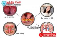 Triệu chứng nuốt nước bọt đau họng nguy hiểm không thể xem nhẹ