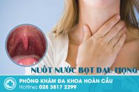 Sai lầm khi xem nhẹ triệu chứng nuốt nước bọt đau họng