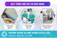 Giới thiệu kỹ thuật nội soi tai mũi họng an toàn chính xác không đau