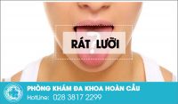 Cảnh báo bệnh lý về họng qua hiện tượng rát lưỡi đau họng