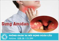 Sưng amidan nguy hiểm ra sao và làm gì để hết sưng?