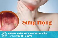 Cách giảm sưng họng hay bạn không nên bỏ qua