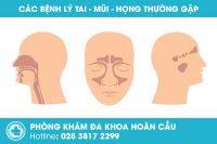 Khám tai mũi họng tư nhân ở đâu tốt tại TP.HCM