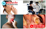 Tại sao bệnh nhân tỉnh Bình Phước lại lựa chọn chuyên gia tai mũi họng Hoàn Cầu ở TPHCM?