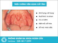 Triệu chứng viêm họng không nên bỏ qua