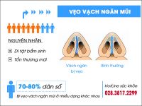Tổng quan về căn bệnh vẹo vách ngăn mũi gặp ở nhiều người