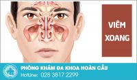 Viêm đa xoang - bệnh nhà nhà gặp phải