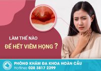 Làm thế nào để hết viêm họng?