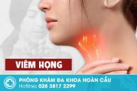 Bệnh viêm họng và những thông tin cần biết