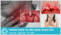 Đau họng và những tác hại cần hết sức lưu ý