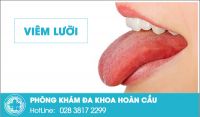 Viêm lưỡi - đa dạng trong hình thức, phức tạp trong điều trị