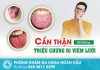 Bệnh viêm lưỡi là gì? Có nguy hiểm không?